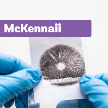 Magic Mushroom Sporeprint | McKennaii